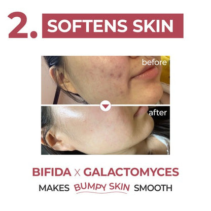 Numbuzin – No. 3 Skin Softening Serum, 50ml