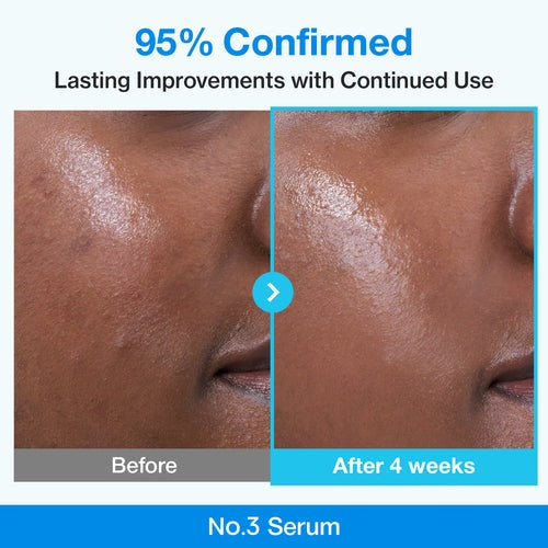 Numbuzin – No.3 Blue Bio-Retinol Pore Refining Serum, 30ml